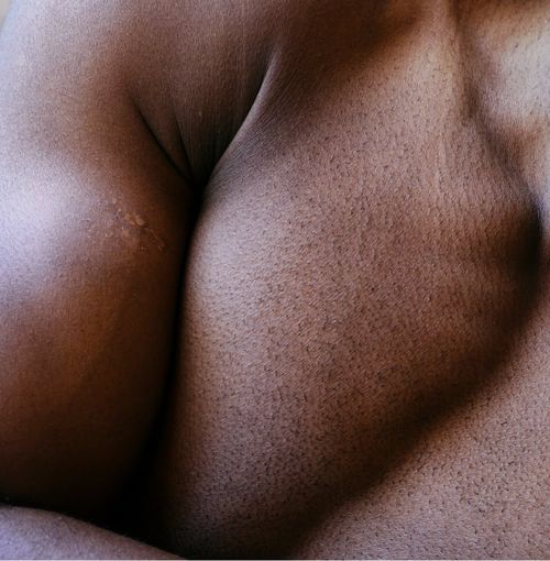 14_Low-Testosterone--Condition-And-Diagnosis_001
