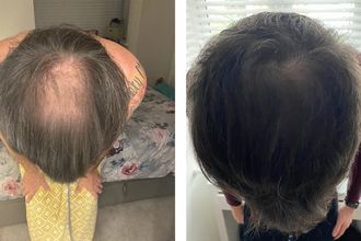 james-hair