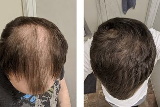 david-hair