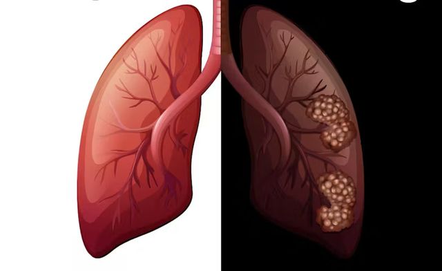 smoking before and after