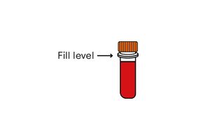 Step 11