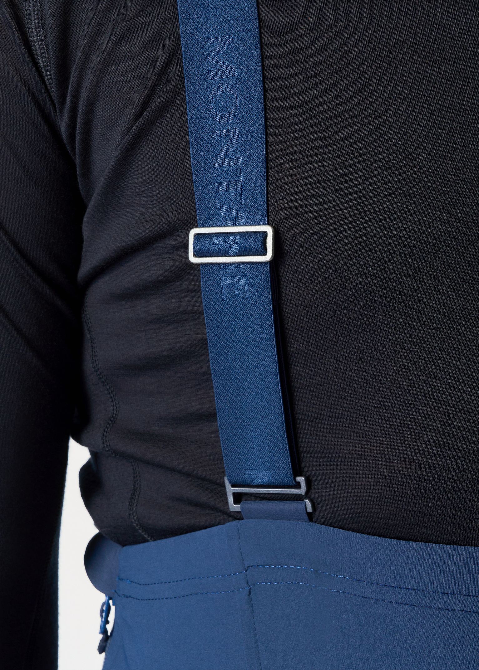 Removable braces