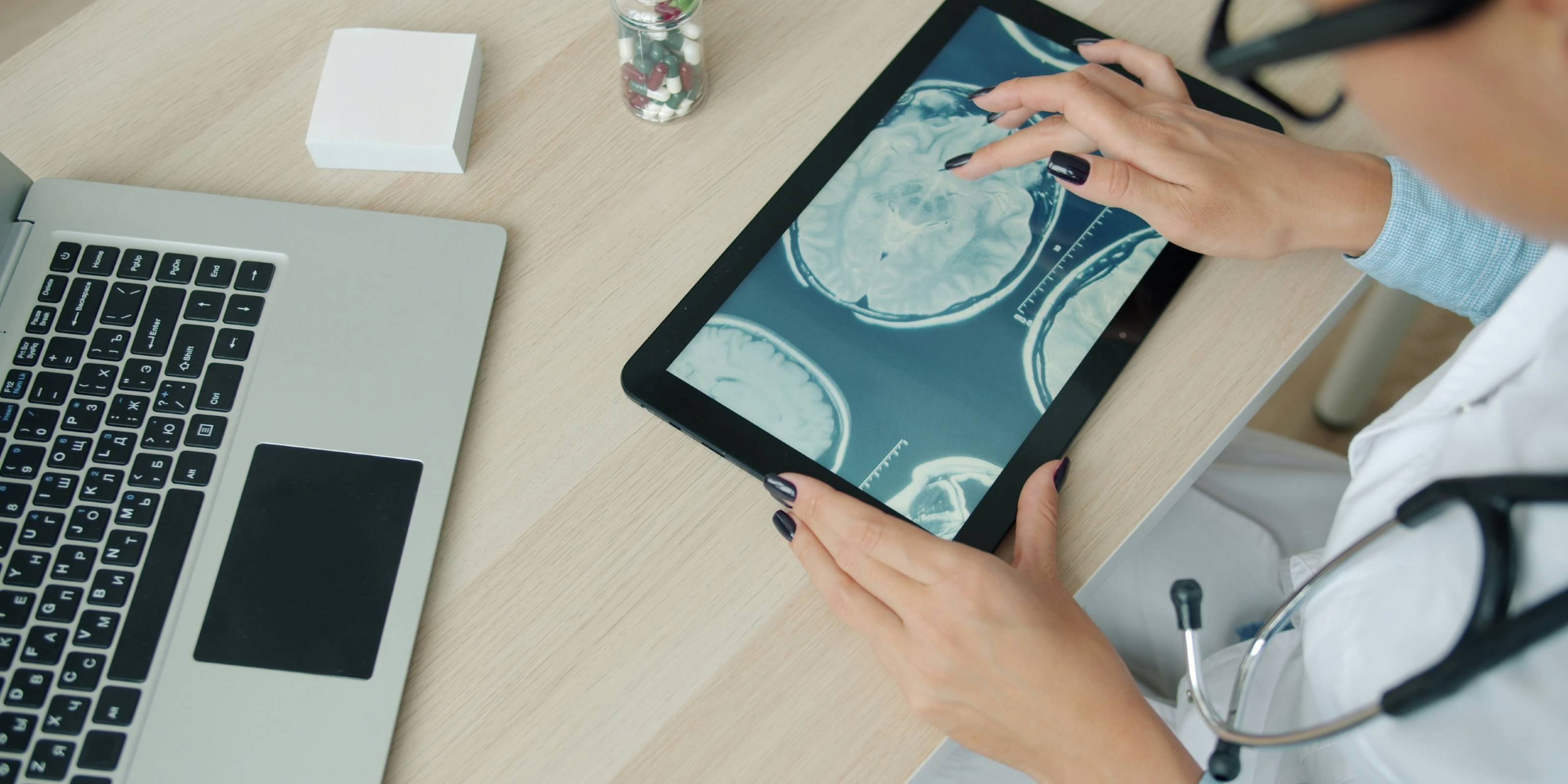 Eine Ärztin tippt auf einem Tablet, auf dem eine CT-Darstellung zu sehen ist. Daneben steht ein Laptop.