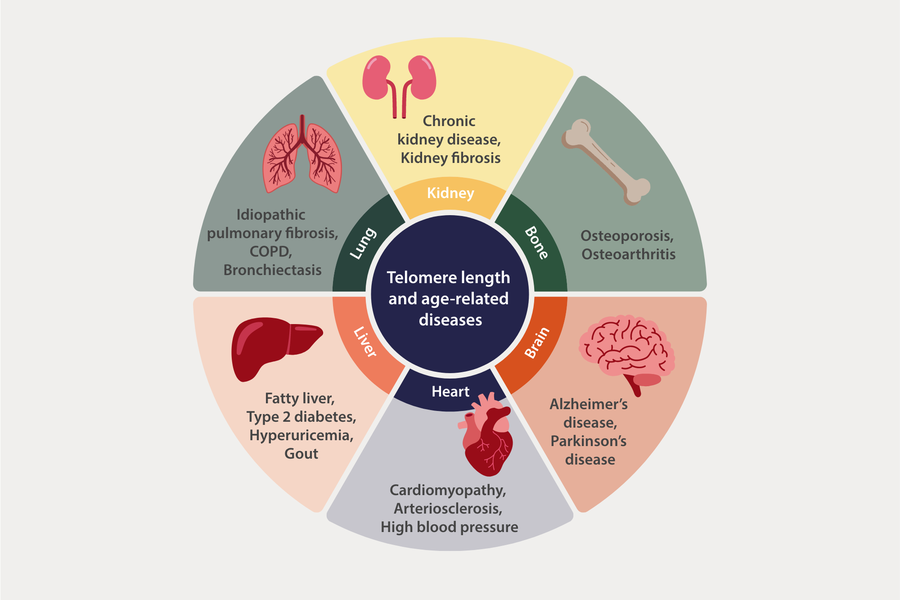 Telomere length and age-related diseases