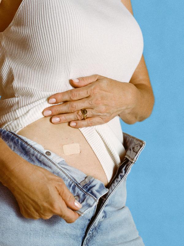 Estrogen patch backordered? Don’t panic 