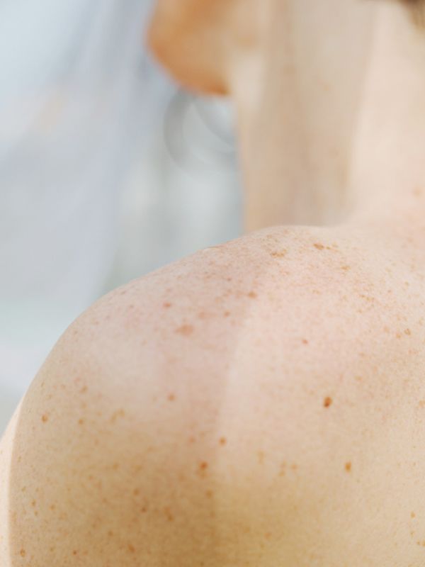 Menopause and body odor: Why it happens and what can help