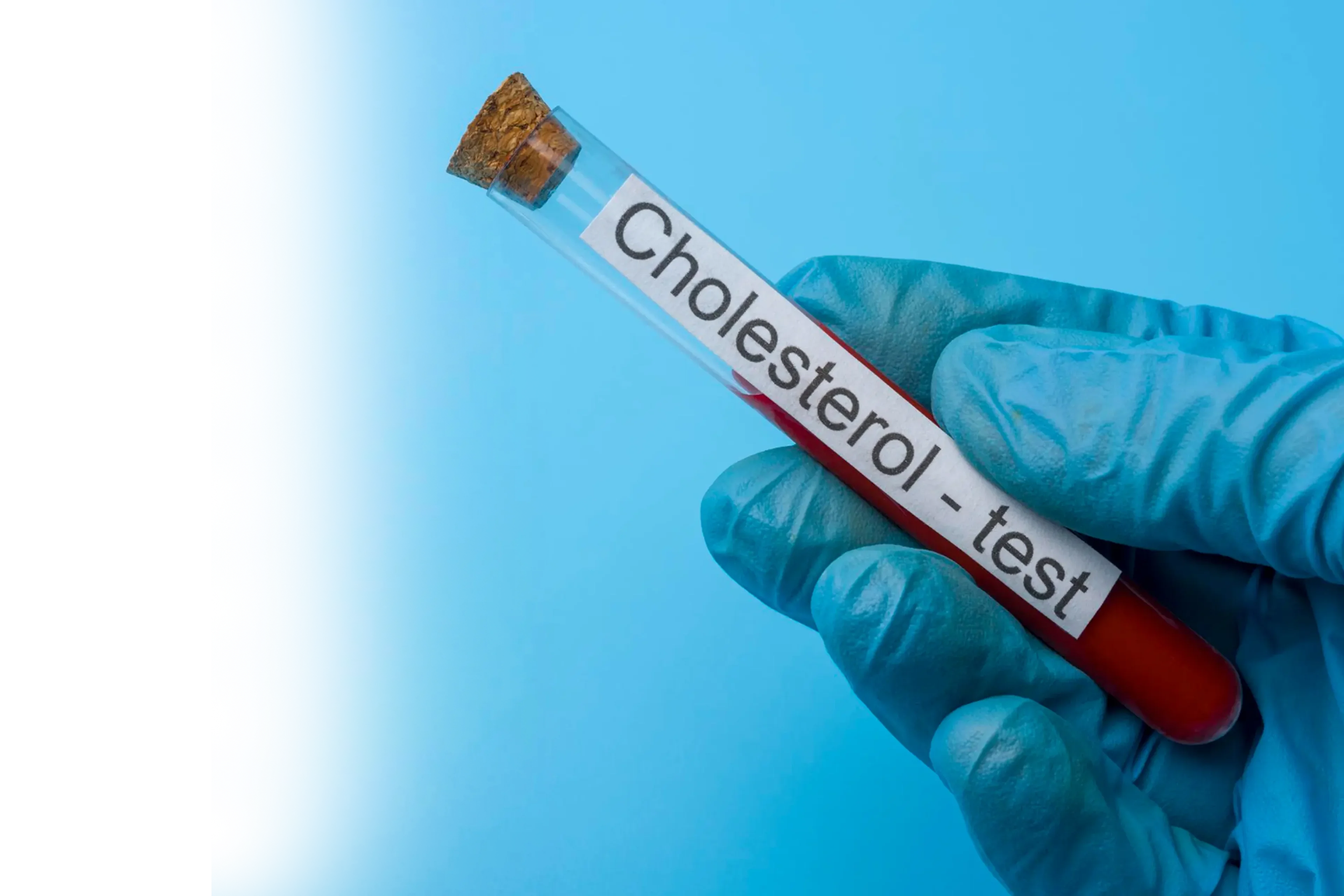 Χέρι με μπλε ιατρικό γάντι που κρατά σωλήνα εξέτασης αίματος χοληστερόλης σε γαλάζιο φόντο