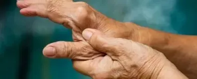 Hand met onregelmatigheden die wordt vastgehouden door andere hand