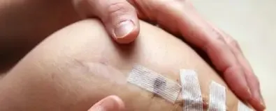 Knie die wordt vastgehouden met litteken, wond en hechtpleisters