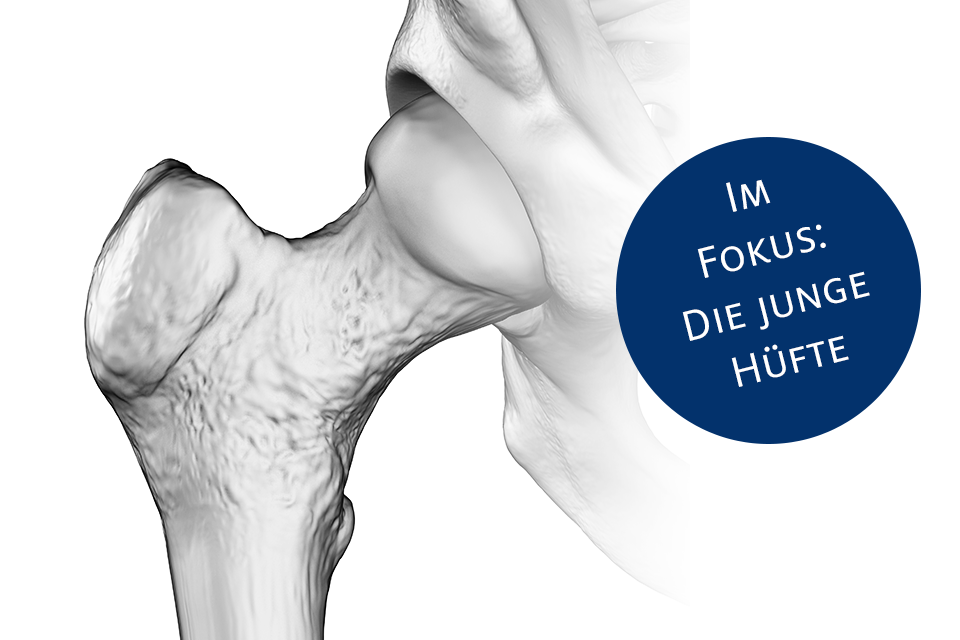 Hüftgelenk 3D