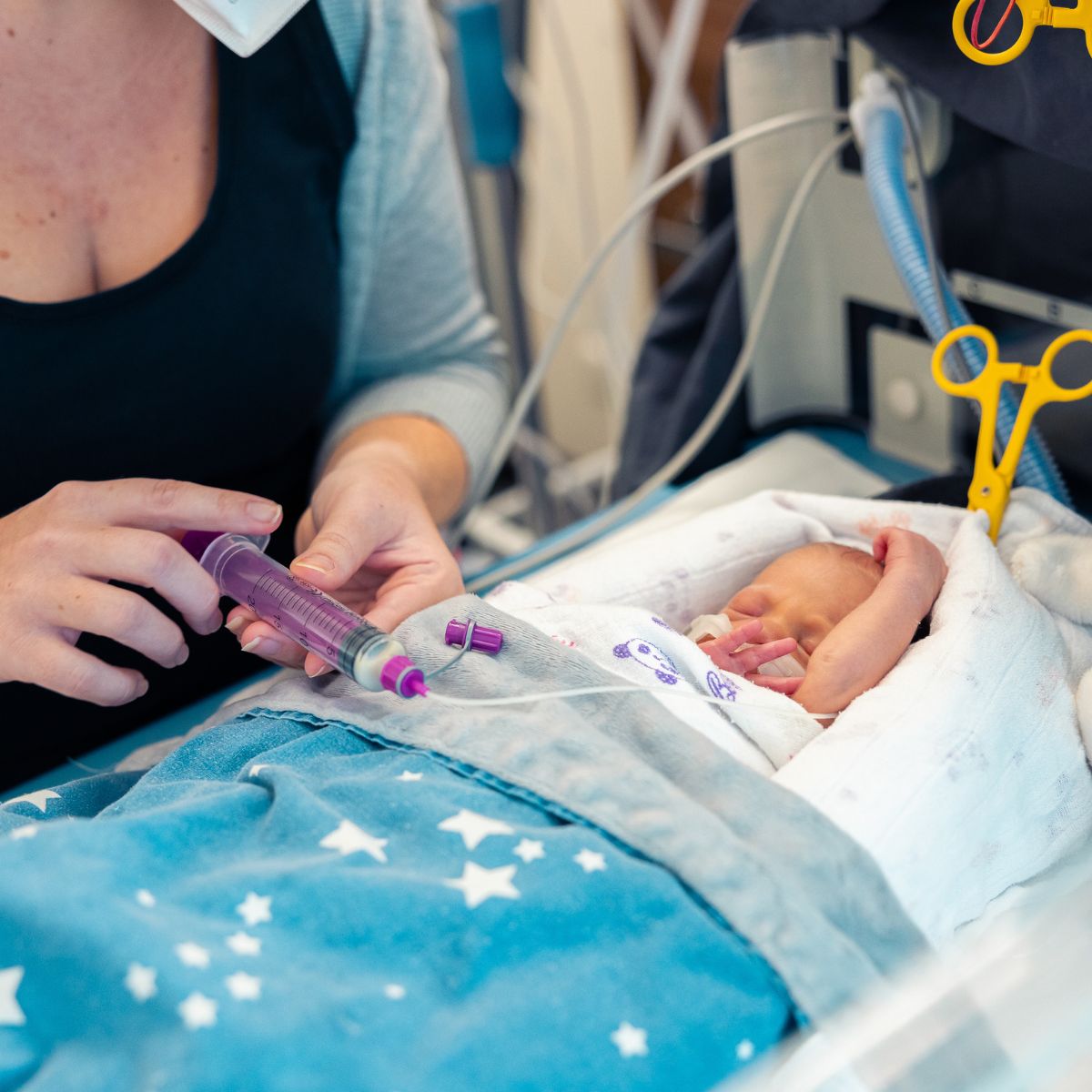 Eine Mutter ernährt ihr Baby über eine Sonde mit Muttermilch.