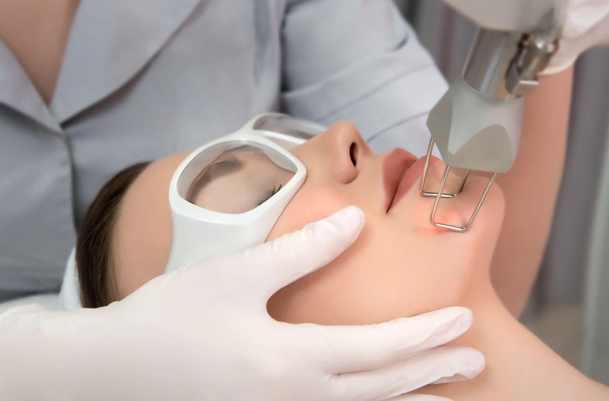 Tratamiento de rejuvenecimiento facial con láser CO2 fraccionado para eliminar manchas y cicatrices de acné