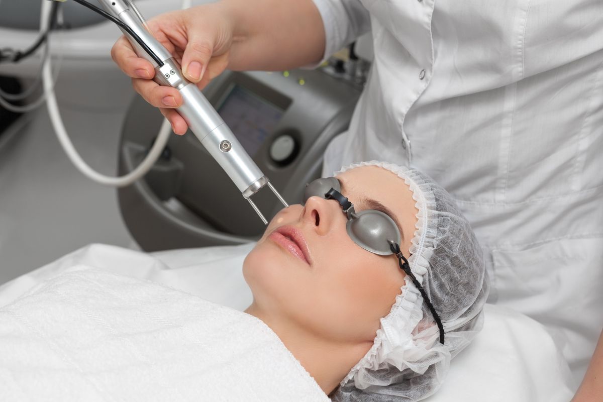 Tratamiento de rejuvenecimiento facial con láser CO2 fraccionado en clínica estética