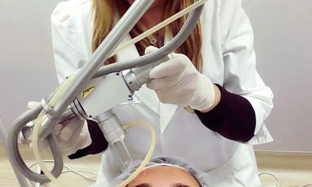 Tratamiento estético con Láser CO2 fraccionado realizado por Dra. Giselle Zaror para rejuvenecimiento facial