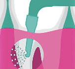Perio-Mate