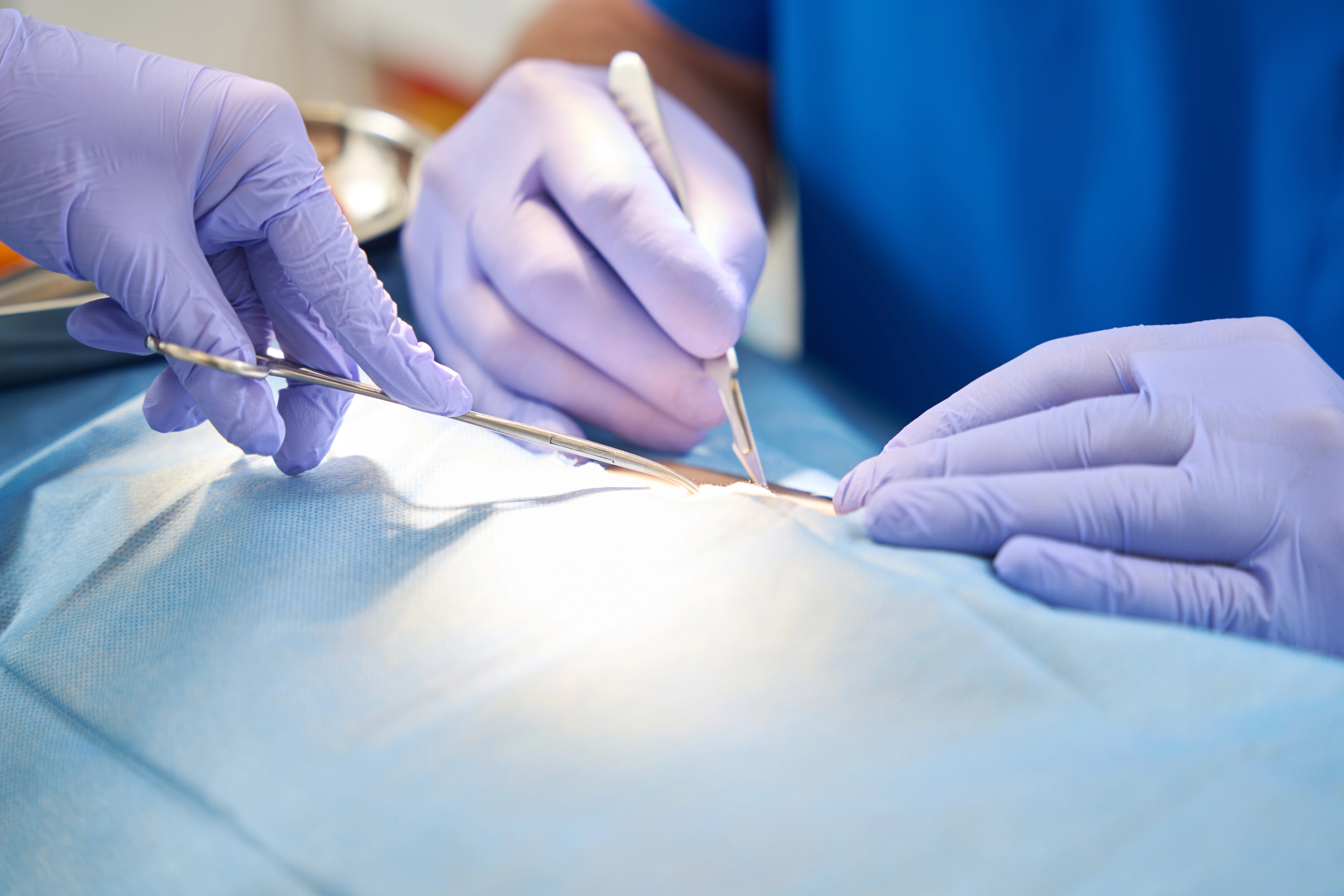 Surgeons wearing purple gloves perform a medical procedure on a patient, using surgical instruments under a bright light.