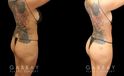 Post-op photos of BBL surgery combined with body contouring liposuction of waist, back, and abdomen. 360 fat removal resulted in a slimmer waist contour all around, enhancing figure to show a dynamic volume increase of the butt with lifted position while standing in a relaxed posture. Patient reported a comfortable recovery without complications.