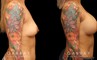 Silicone implant breast augmentation photos showing before and after the procedure (post complete recovery). Patient breasts are demonstrably rounder with a balanced volume increase that suits her body shape.