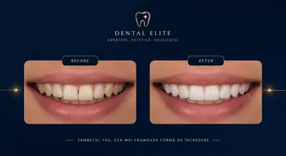 Peste 15 tipuri de conținut, gata de pus pe ecran