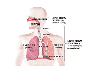 Diagram of the human respiratory system highlighting nasal chamber, pharynx, larynx, trachea, lungs, bronchi, and potential airway injuries.