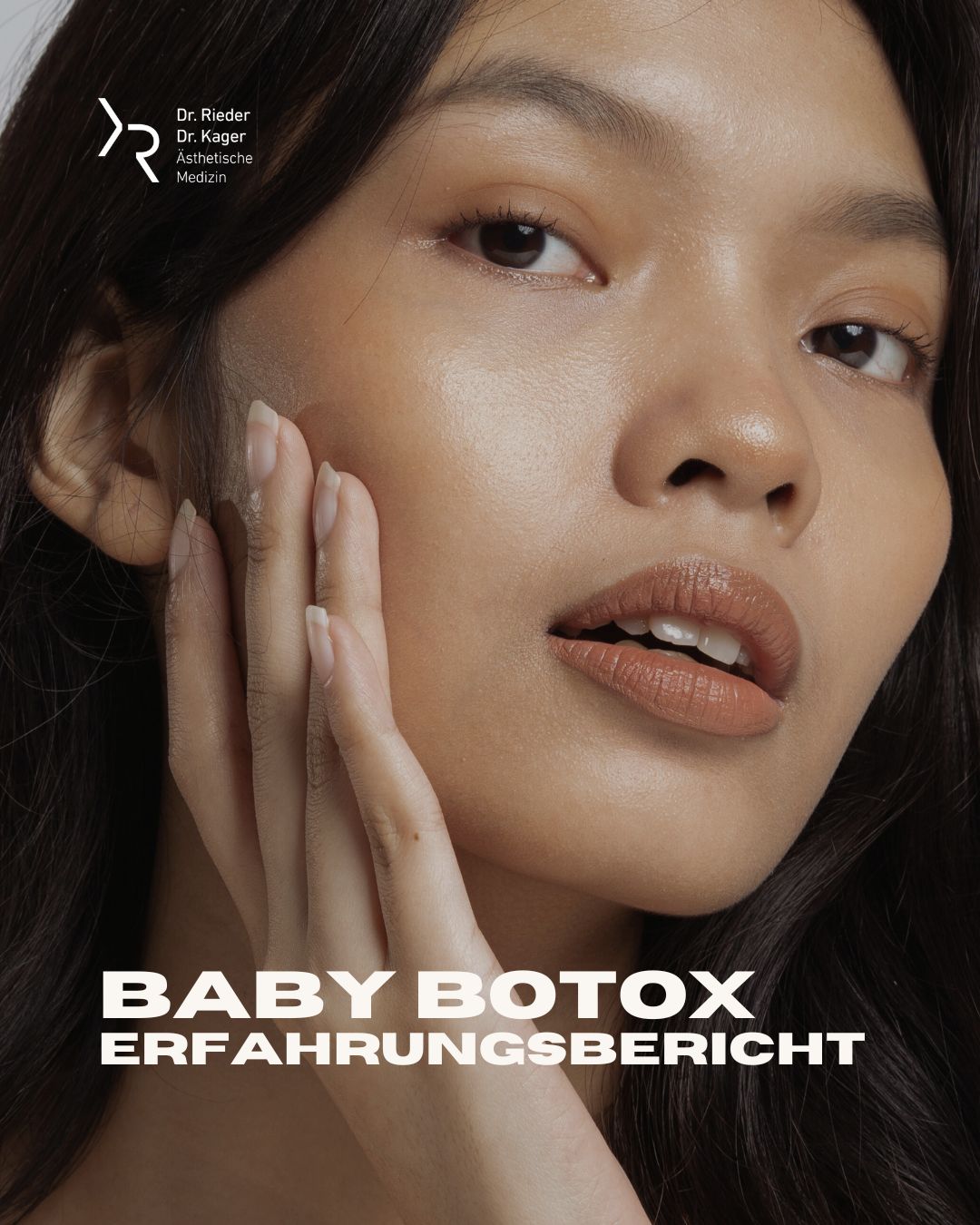 Baby Botox Erfahrungsbericht