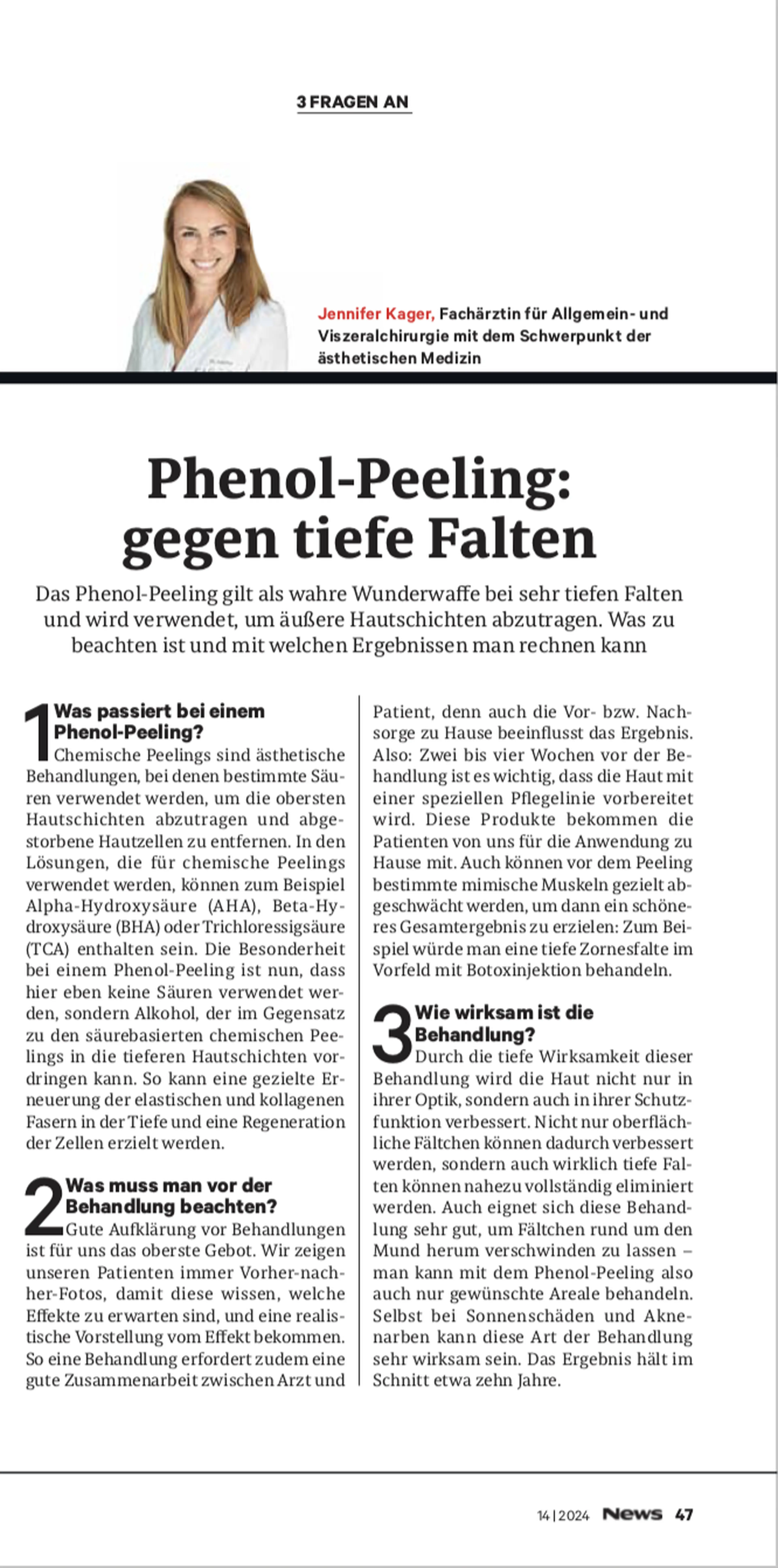 Phenol-Peeling gegen tiefe Falten