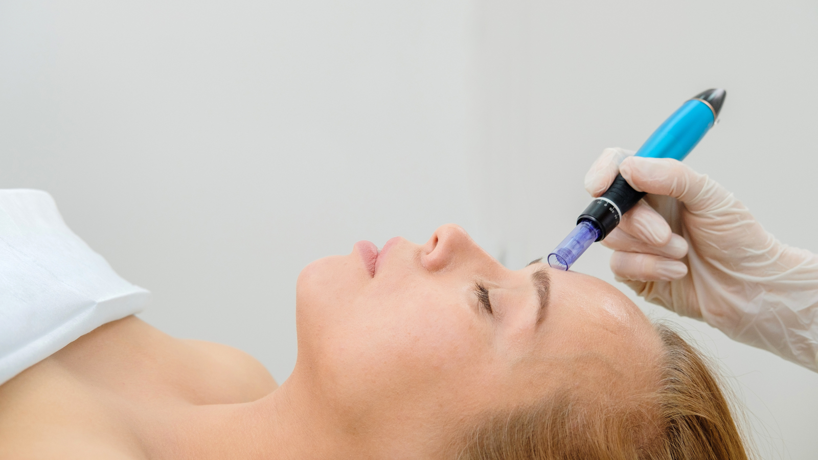 Anti-Aging Microneedling mit dem Dermapen
