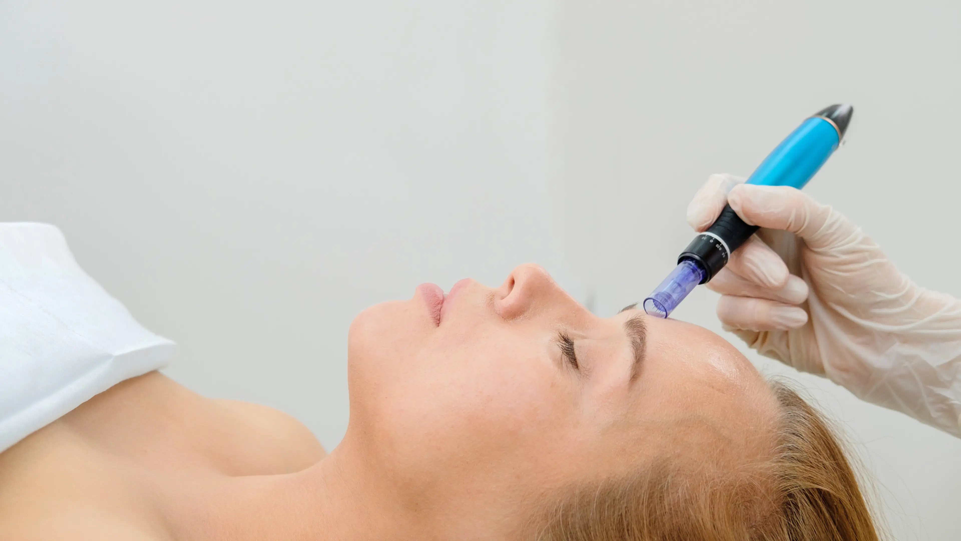 Anti-Aging Microneedling mit dem Dermapen
