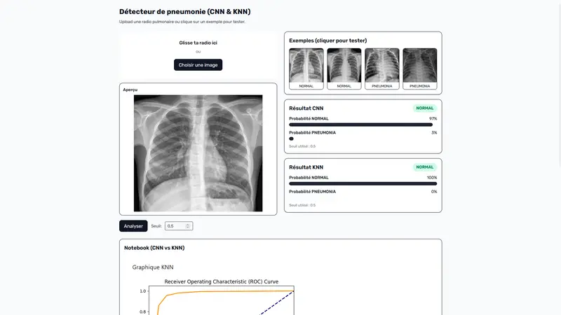 AI Pneumonia Detector – Détection de pneumonie par IA