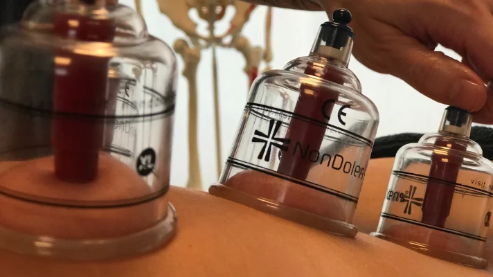 Oprindeligt traditionel kinesisk behandling