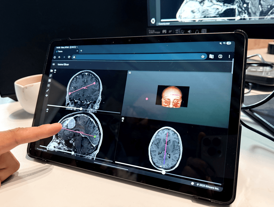 3D Pre-Operative Visualisation Tool