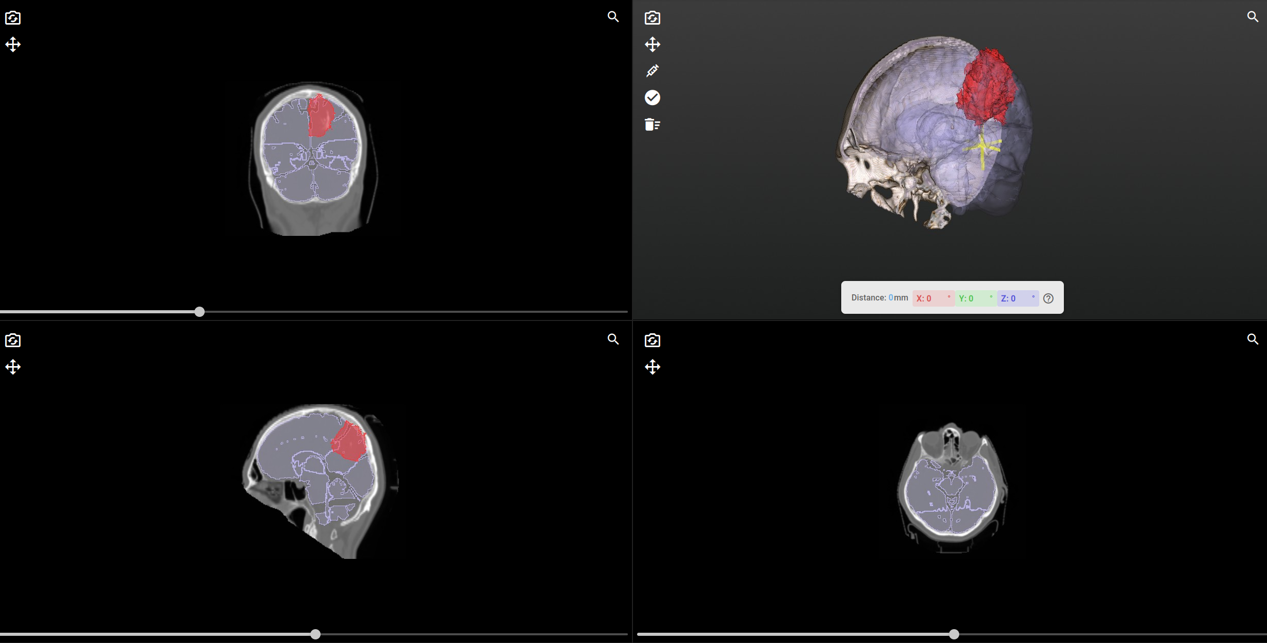 Reshaping Medical Viewers to Be More Accessible