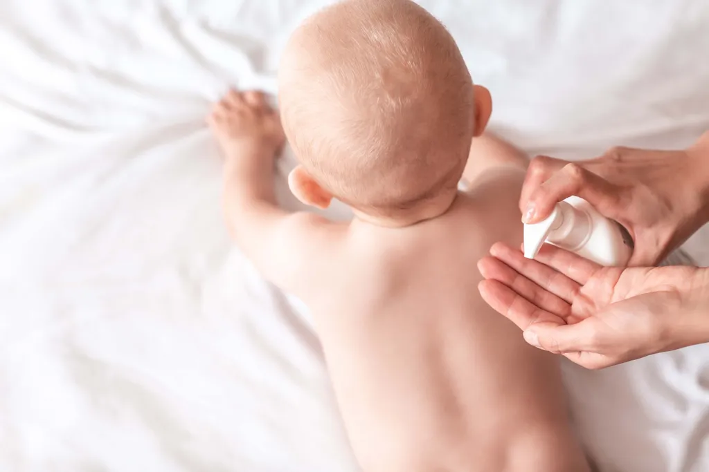 Pflegecreme wird auf den Rücken eines Babys aufgetragen