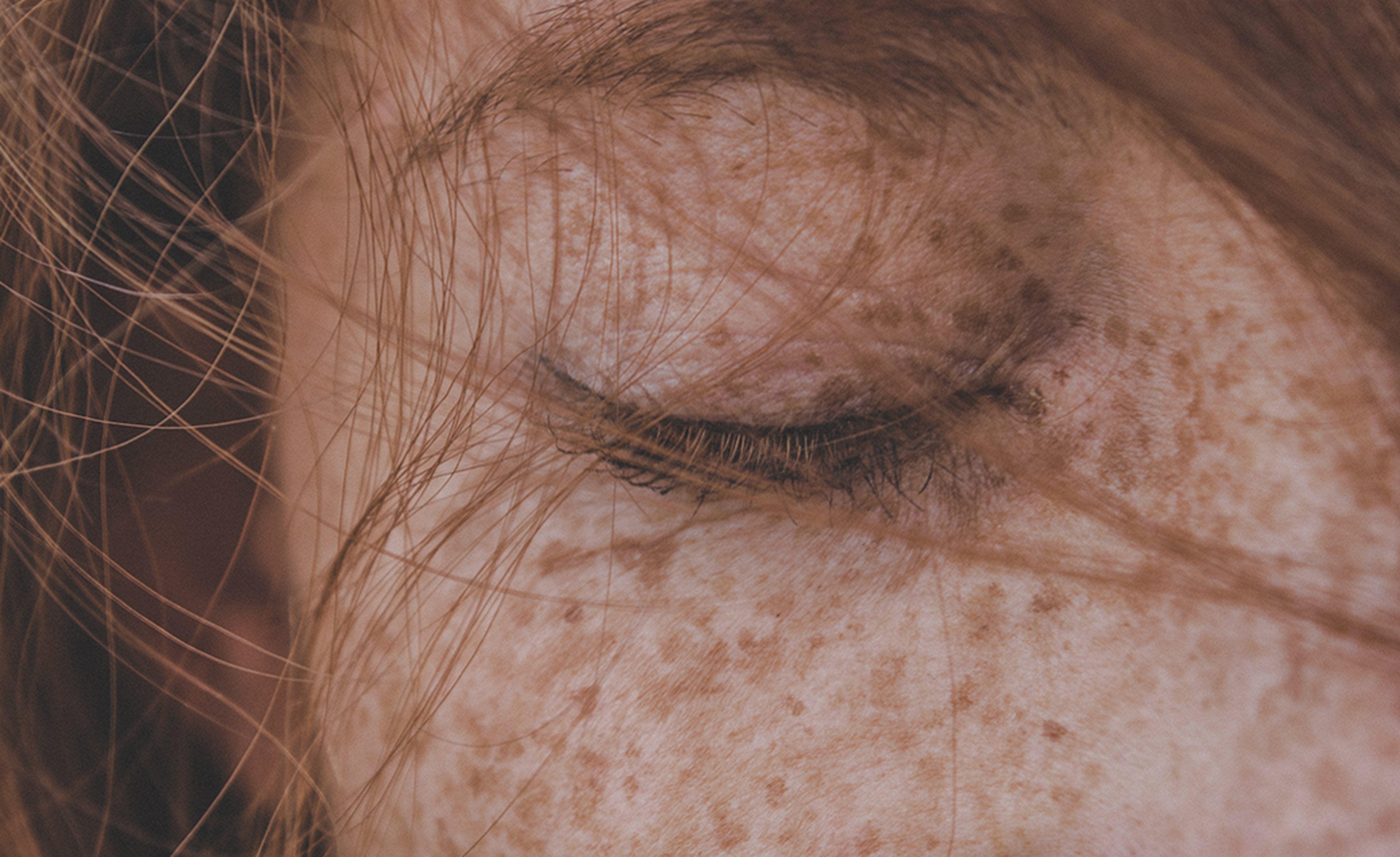 Image of a closed eye