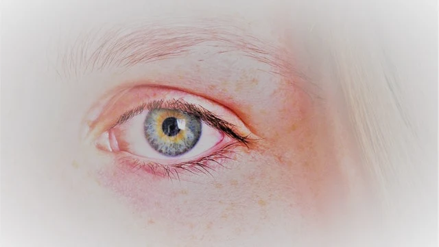 Collyre pour yeux secs