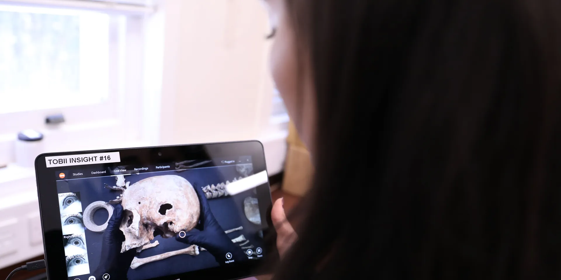 标准化法医学中的视觉检测方法 