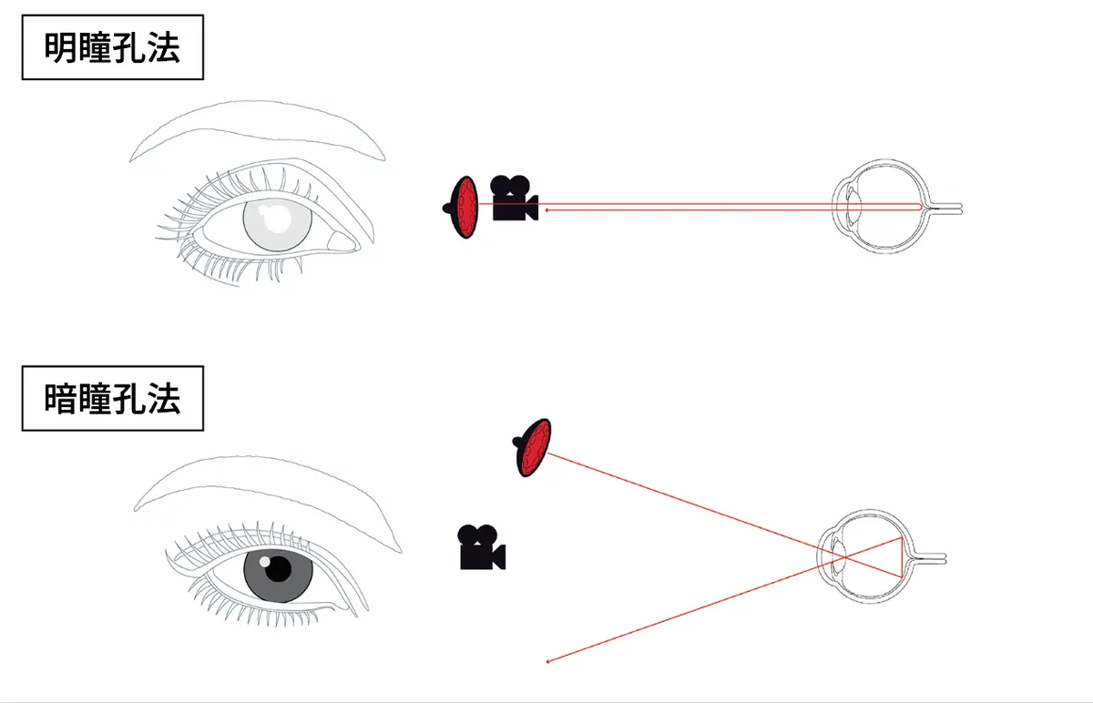 3. 明瞳孔法と暗瞳孔法