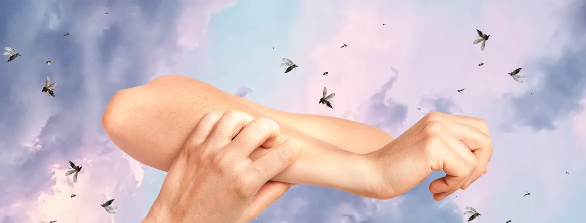 Header - muggen - krabben - dromen - slapen - jeuk - Shutterstock