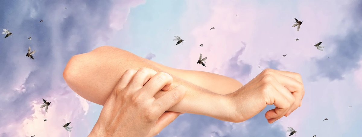 Header - muggen - krabben - dromen - slapen - jeuk - Shutterstock