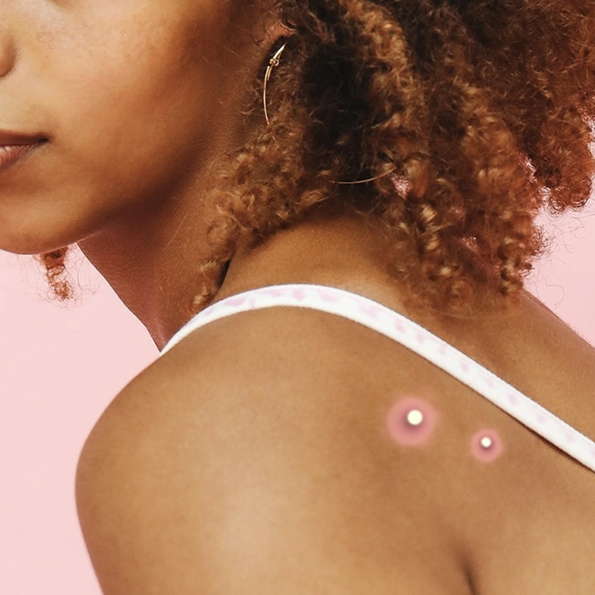 Header/hero - puist - rug - pukkel - Getty