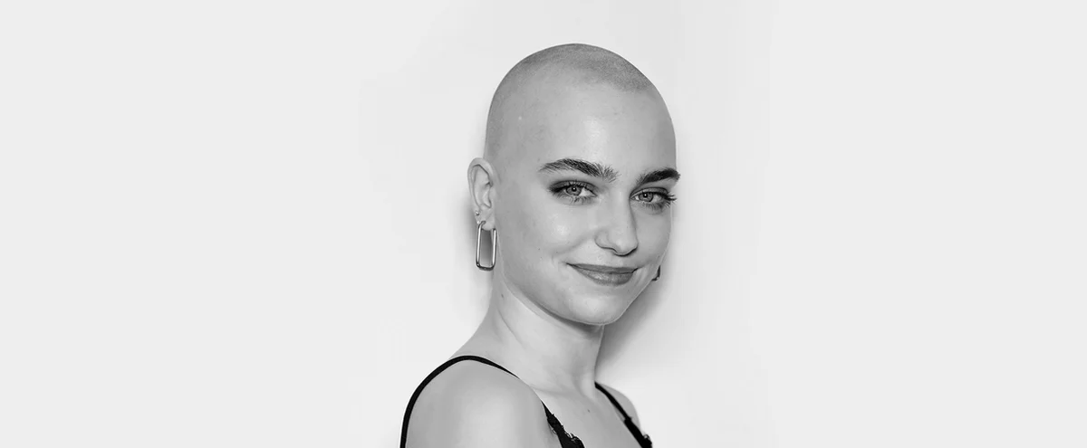 Header - Hannah - Anne - alopecia - zwart wit
