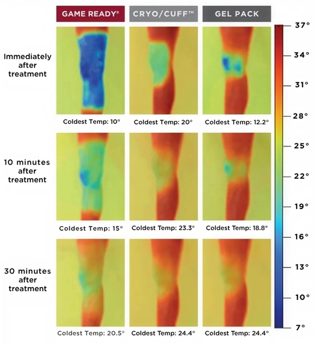 Thermal images showing temperature changes of legs after treatment with Game Ready, Cryo/Cuff, and Gel Pack over 30 minutes.