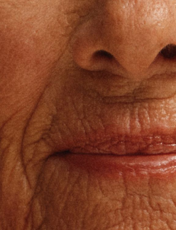 Close-up of an older person’s smile