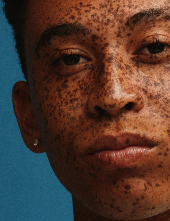 Close-up of a young man’s freckled face