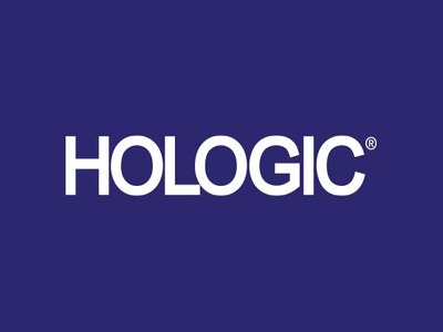 Hologic Case Study