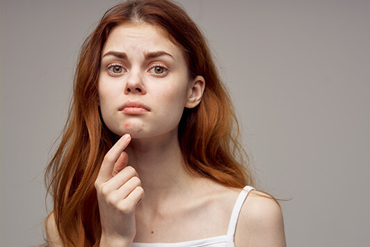 Skin Purging vs. Breaking Out