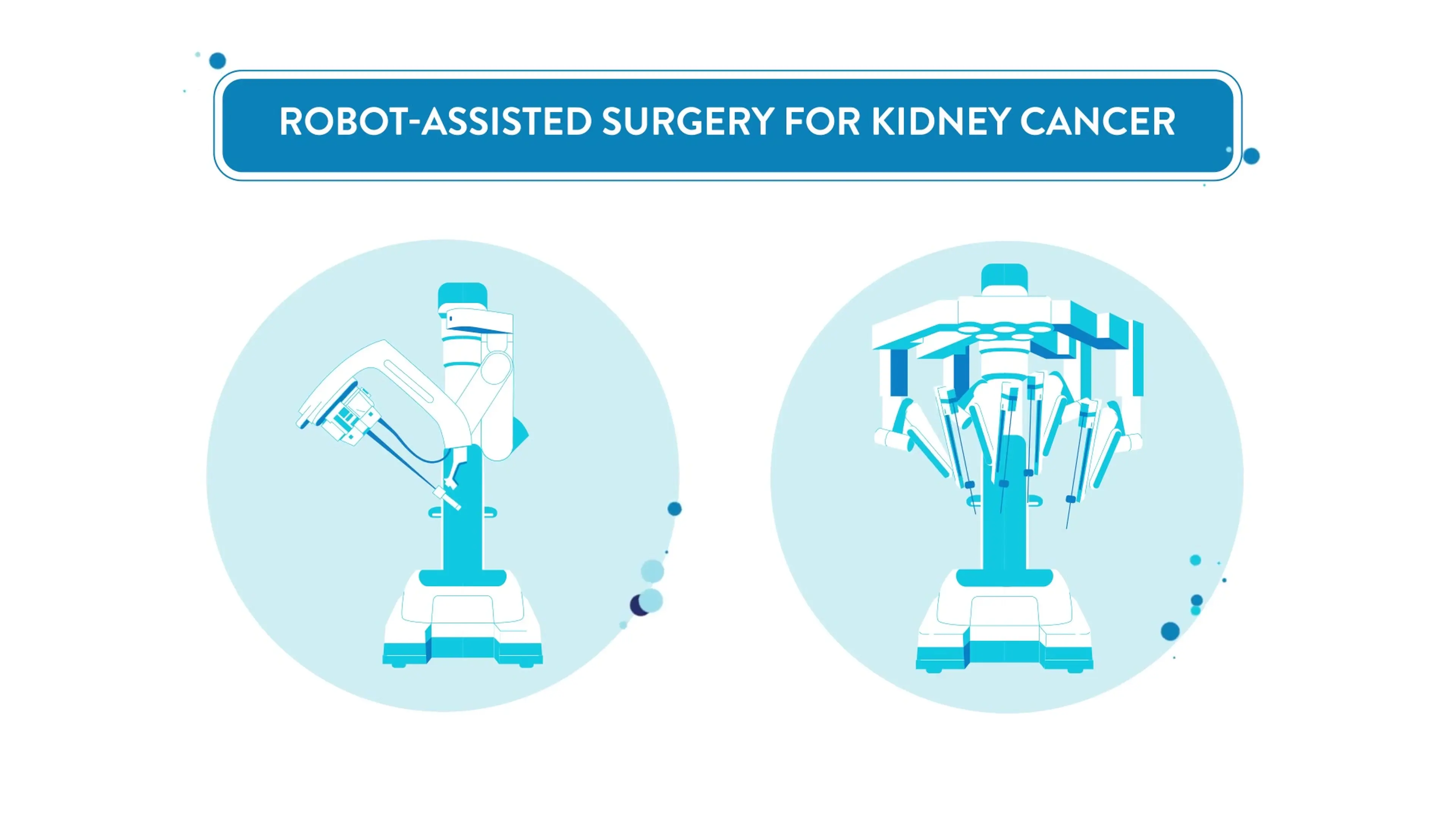 Animated surgical robots illustrating robot-assisted surgery for kidney cancer, from a Motifmotion patient education video