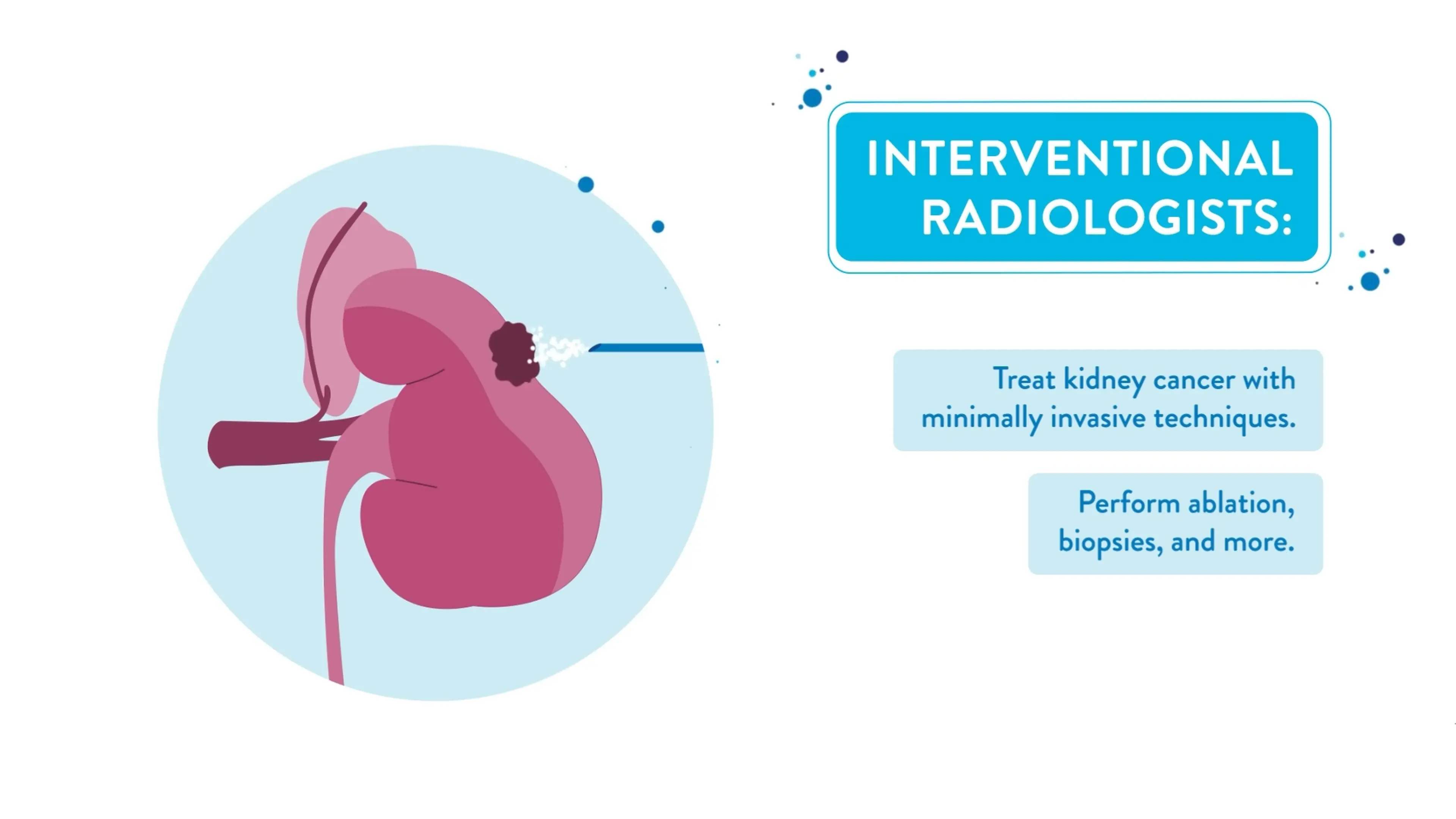 Animated kidney anatomy beside a labeled explanation of what interventional radiologists do, from a Motifmotion patient education video