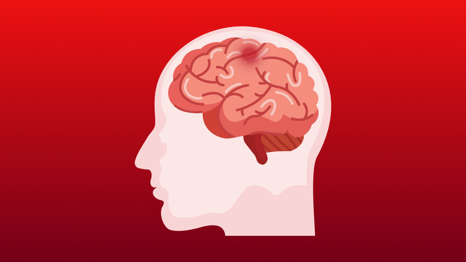 Stroke Awareness Blog Banner