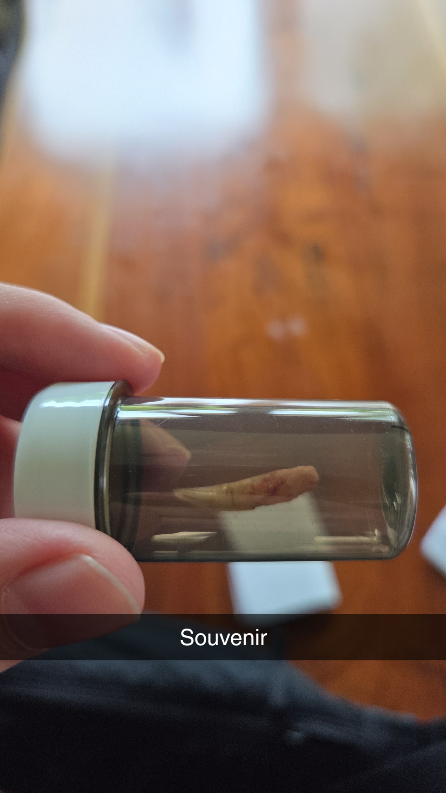 A pulled-out cat tooth in a plastic container with the caption "Souvenir"